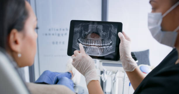 Licensed Wisdom Tooth Removal service in Port Barrington, IL - Smile Center Dentistry